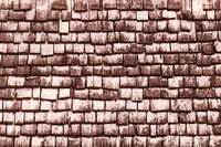 Shingles